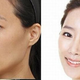 Illustration for article titled Oh god, Korean plastic surgery will never cease to amaze me